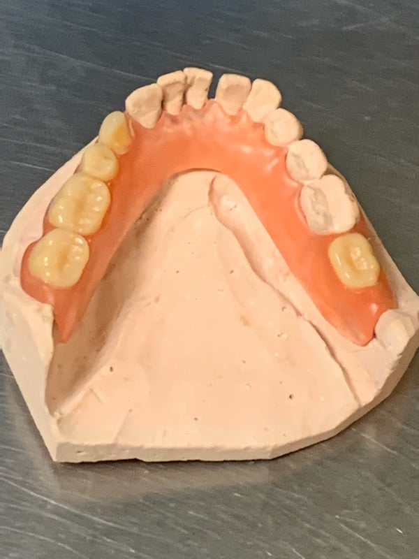 Flexible Partial Denture
