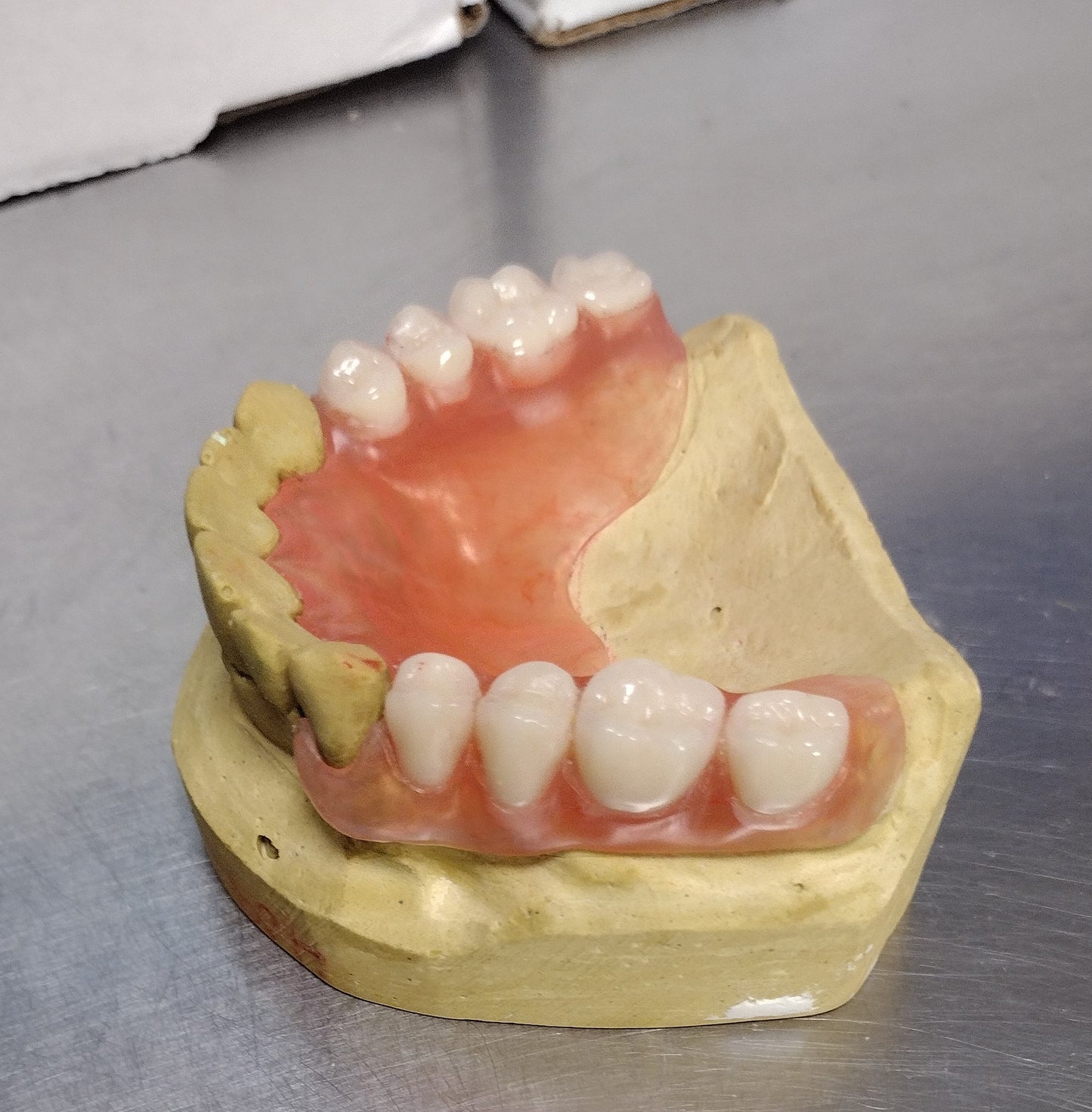Flexible Partial Denture